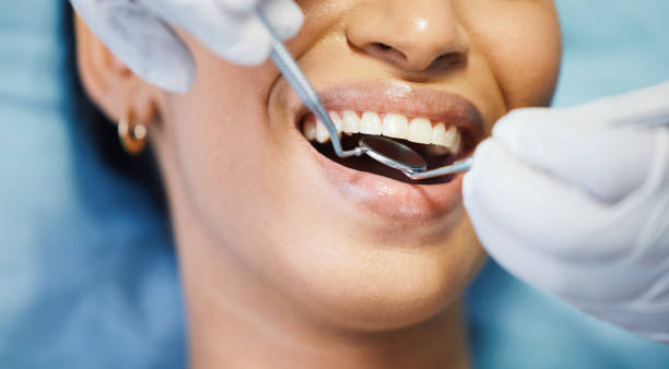 Best Emergency Broken Tooth Repair in Brookhaven, PA